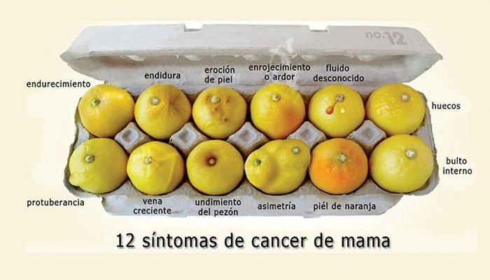 El Cáncer de Seno