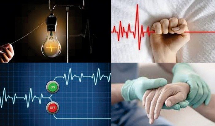 La Eutanasia en el Ser Humano